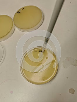 0.01ml of solution being placed on an agar plate using a micropipette