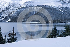 150 Freezing Cold Winter Lake Scene
