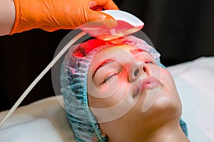 20-25 years old woman receiving a non-surgical rejuvenation procedure, RF face lifting with the use of electric device