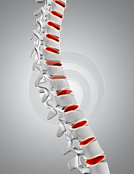 3D close up of spine with discs highlighted