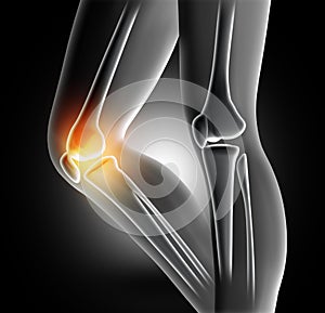 3D female medical image of bones in knee