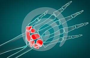 3D illustration of Carpal, medical concep