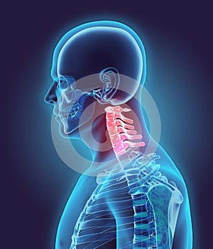 3D illustration of Cervical Spine, medical concept.