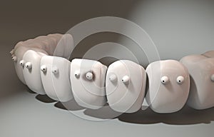 3d illustration. Cute Teeth noticed among themselves the patient