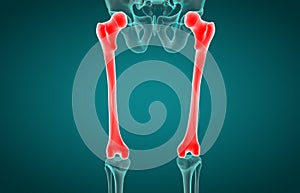 3D illustration of Femur xray