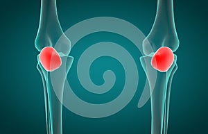 3D illustration of Patella, medical concept.