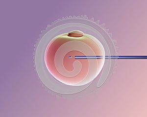 3D illustration of piezo ICSI (intra-cytoplasmic sperm injection). Realistic.