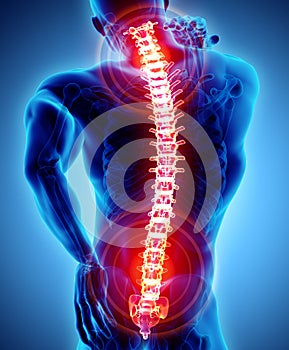 3D Illustration of sacral and cervical painful.