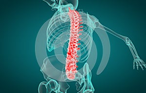 3D illustration of Spine, medical concept