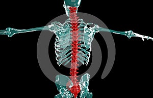 3D illustration of Spine, medical concept