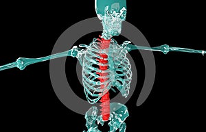 3D illustration of Spine, medical concept