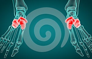 3D illustration of tarsal bone, x-ray