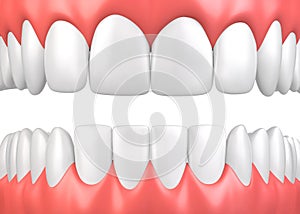 3D illustration teeth and gum model.