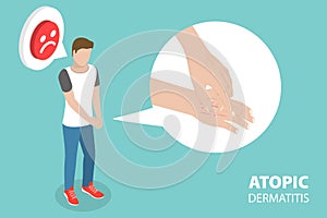 3D Isometric Flat Vector Conceptual Illustration of Atopic Dermatitis