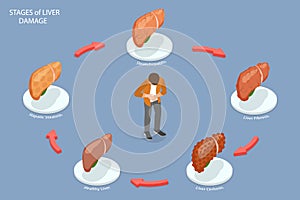 3D Isometric Flat Vector Conceptual Illustration of Stages Of Liver Damage