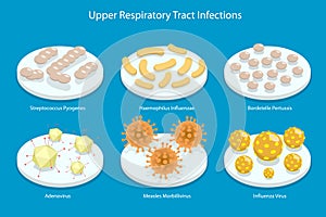3D Isometric Flat Vector Conceptual Illustration of Upper Respiratory Tract Infection