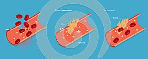 3D Isometric Flat Vector Illustration of Hemostasis