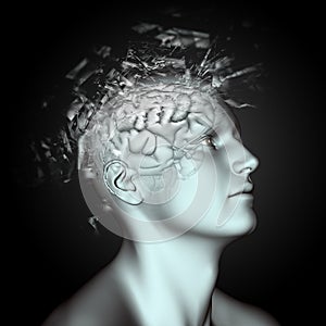 3D male figure with shatter effect on head and brain depicting m