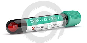 3d render of  blood samples with hepatitis test