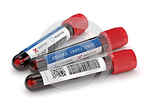 3d render of  blood samples with herpes test