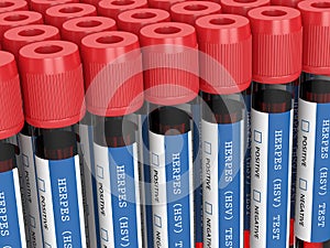 3d render of  blood samples with herpes test