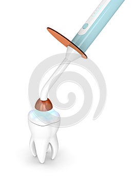 3d render of dental polymerization lamp and light cured onlay