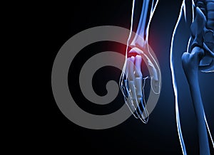 3d render Human hand and wrist pain