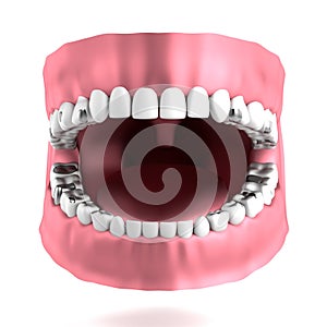 3d render of human teeth with fillings