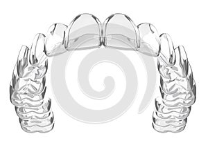 3d render of invisalign removable and invisible retainer