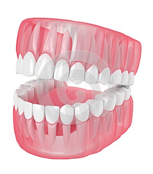 3d render of jaw with teeth over white