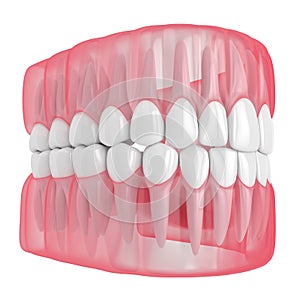 3d render of jaw with teeth over white