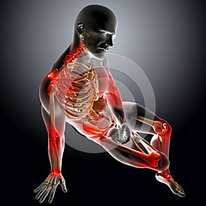 3D render of a male medical figure with joints highlighted