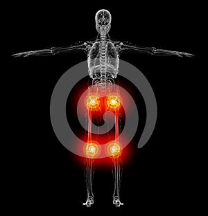 3d render medical illustration of the femur bone