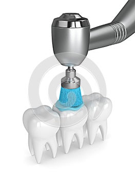 3d render of teeth with dental handpiece and polishing brush
