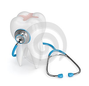 3d render of tooth with dental inlay and stethoscope