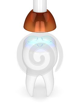 3d render of tooth with dental polymerization lamp and light cured inlay