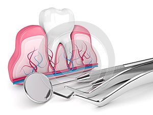 3d render of tooth in gums and dental diagnostic instruments over white