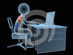 3d rendered medical illustration - wrong sitting posture