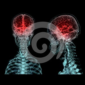 3D rendered medically accurate illustration of the cerebral artery of the head