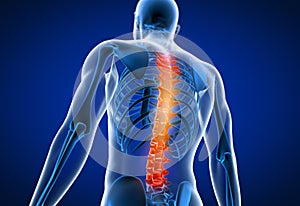 3d rendered medically accurate illustration of a man having a painful back