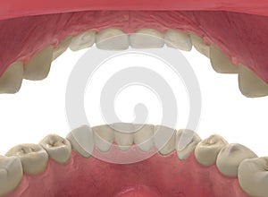 3d rendering. Close up inside of human mouth with yellow teethes on healthy red gum isolated on white background with clipping pat