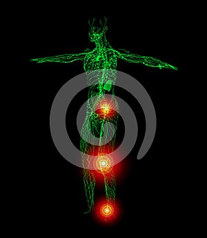 3D rendering illustration of lymphatic system