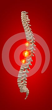 3D rendering illustration of spine bone