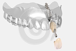 3D rendering teeth