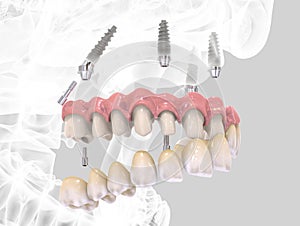 3D rendering teeth