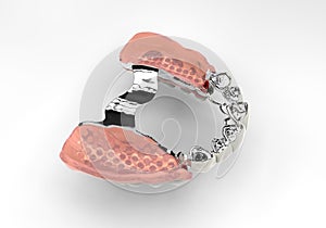 3D rendering teeth