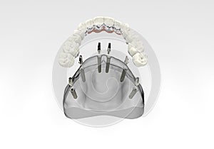 3D rendering teeth