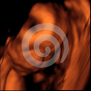 3D Sonogram photo