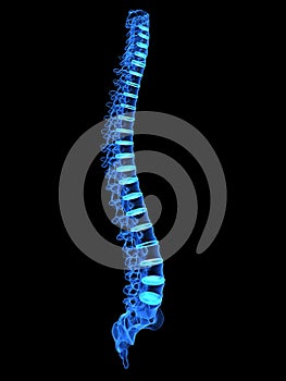 Tridimensional columna vertebral 