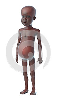 3d Starving African child side view